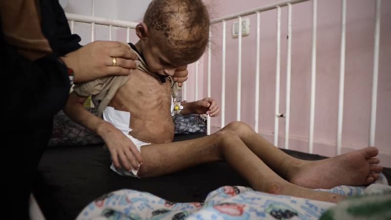 unrwa gazzede 3 yas alti her 3 cocuktan biri son 24 saati yiyeceksiz gecirdi OalZL2BA