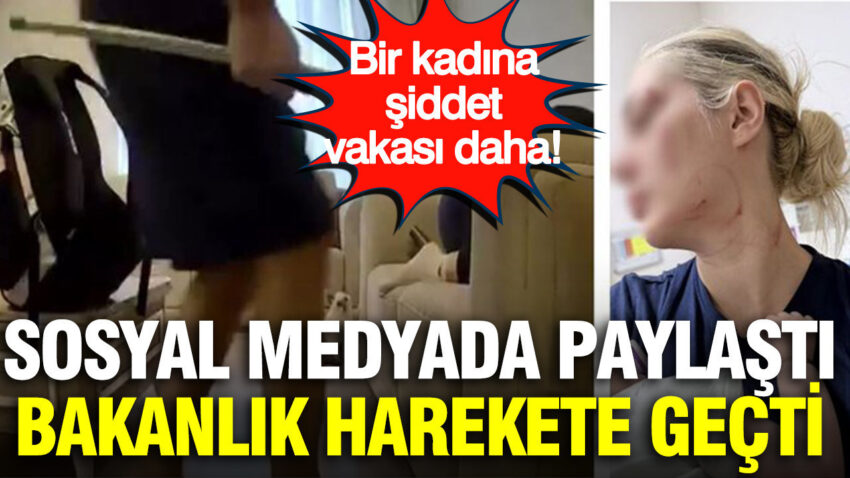 Bir kadina siddet vakasi daha sosyal medyada paylasti bakanlik harekete gecti 9asV3wG9